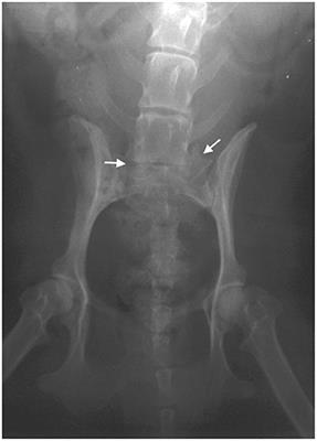 Case Report: Successful Therapy of Spontaneously Occurring Canine Degenerative Lumbosacral Stenosis Using Autologous Adipose Tissue-Derived Mesenchymal Stem Cells